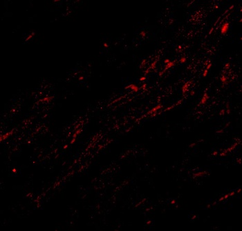 CIDE-A Antibody