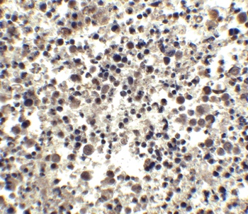 CIDEA Antibody