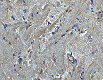 PACS2 Antibody