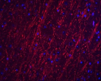 PACS2 Antibody