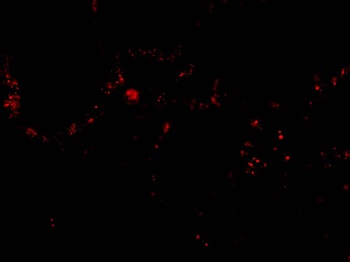p53R2 Antibody