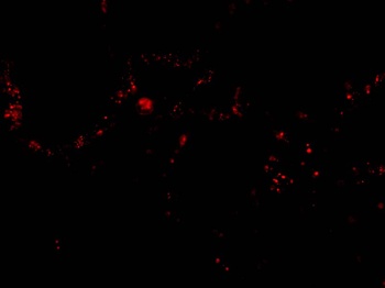 RRM2B Antibody