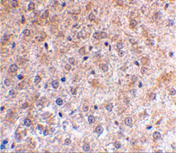 TP53INP1 Antibody