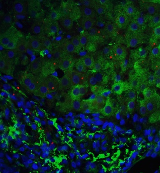 TP53INP1 Antibody