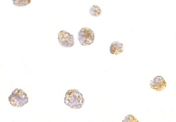 p53AIP1 Antibody