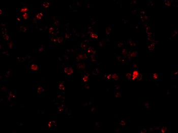 p53AIP1 Antibody