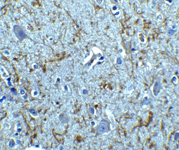 Clusterin Antibody