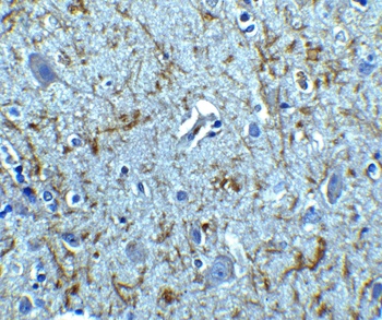 CLU Antibody