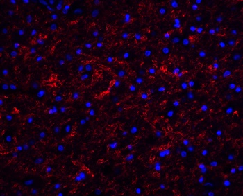 Clusterin Antibody