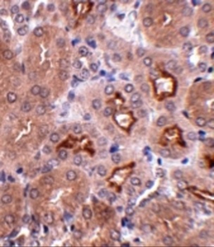 OTUD5 Antibody