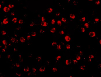 OTUD4 Antibody