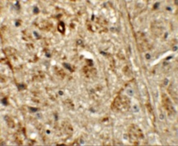 ORMDL1 Antibody