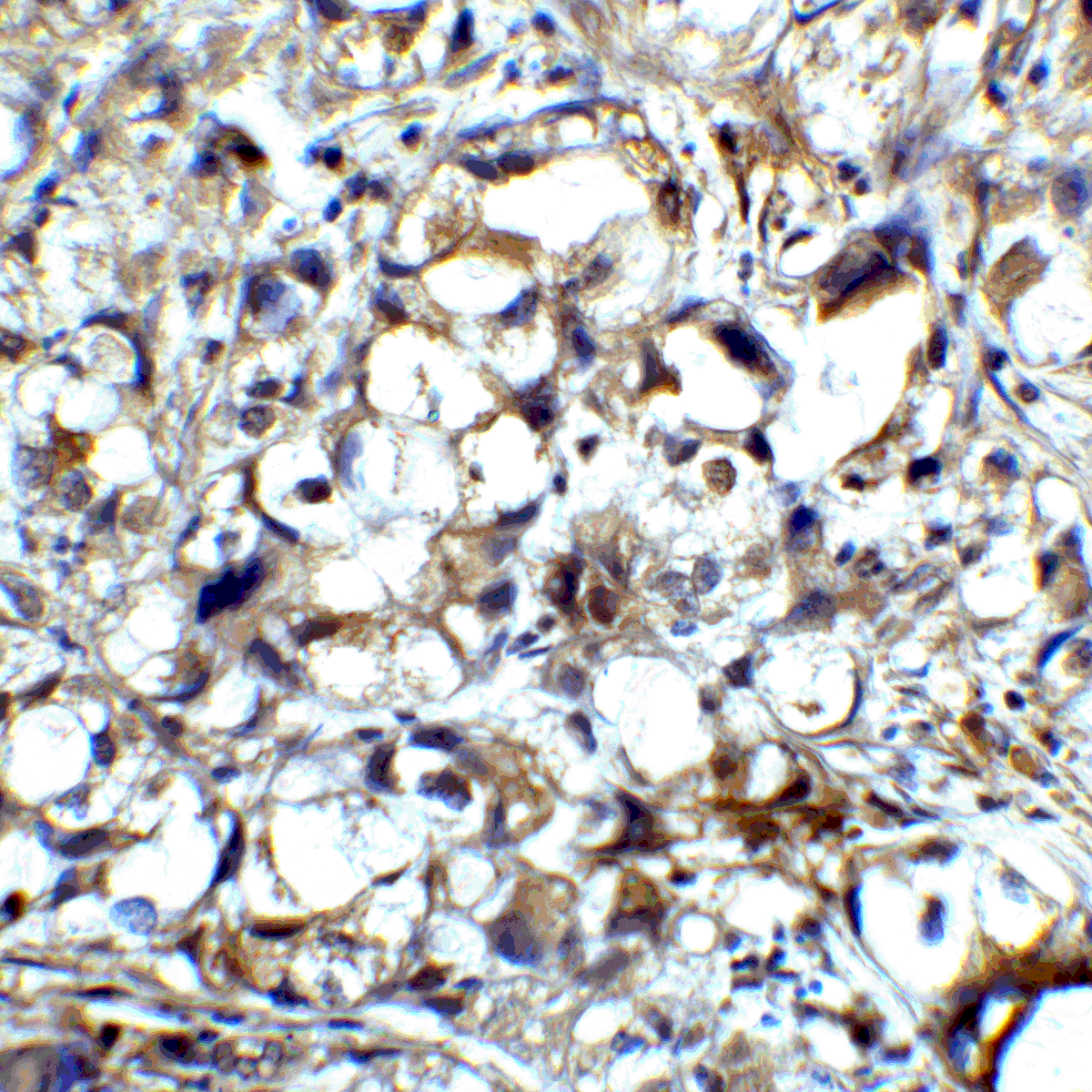 CTLA4 Antibody [1E6]