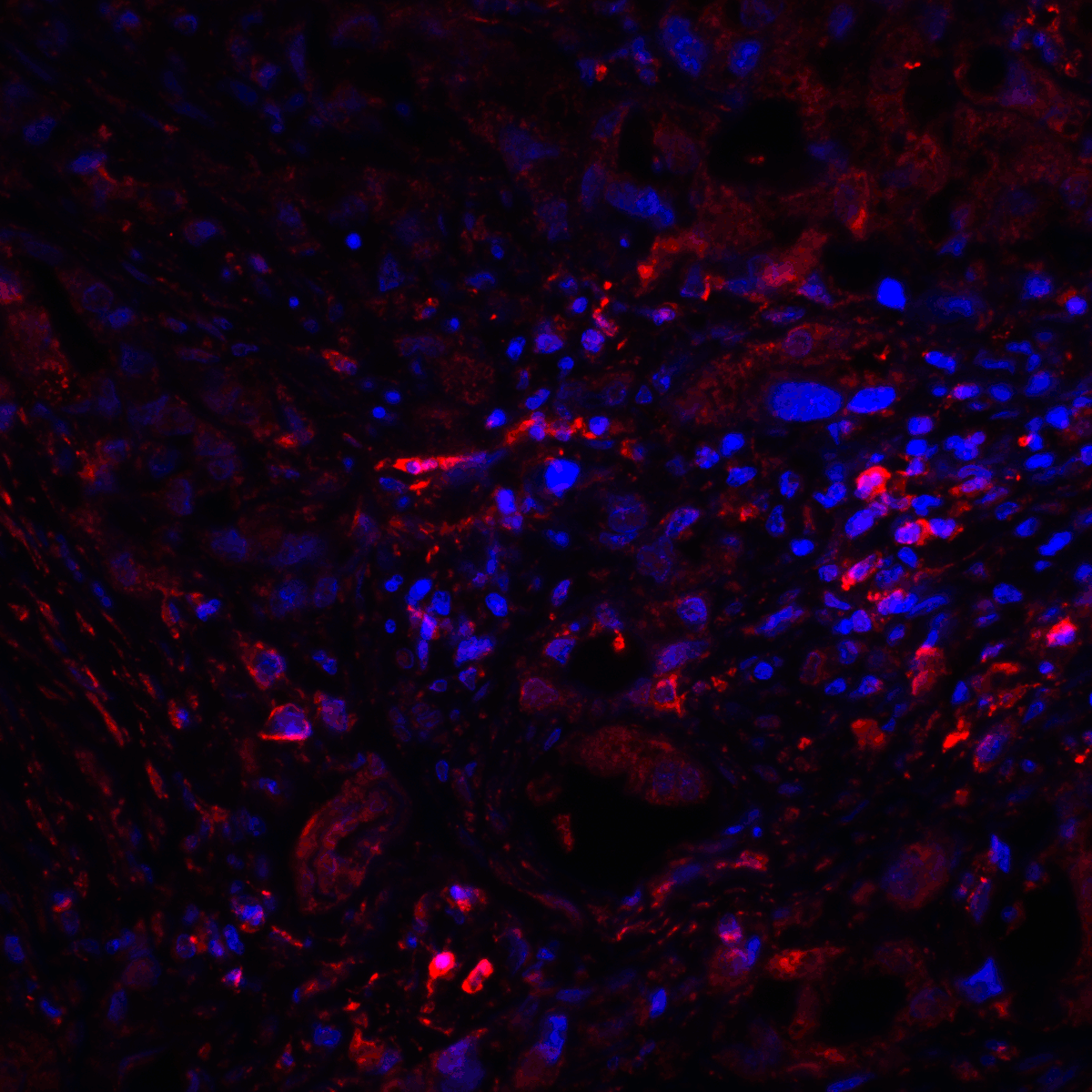 CTLA4 Antibody