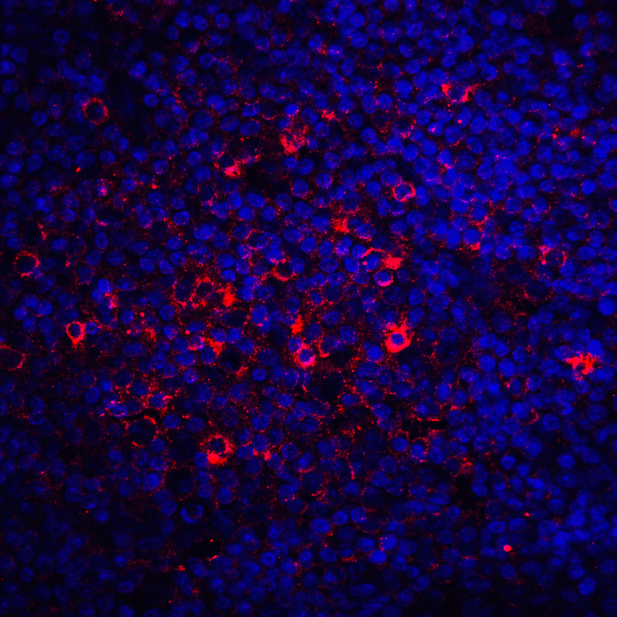 CTLA4 Antibody