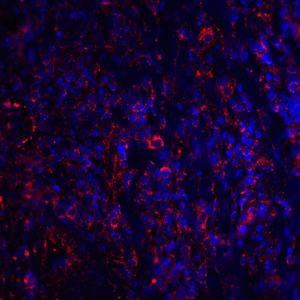 CTLA4 Antibody