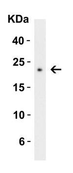 C1QTNF3 Antibody