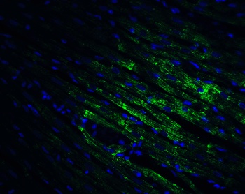 CX3CR1 Antibody