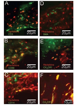CX3CR1 Antibody