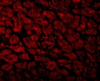 CX3CR1 Antibody