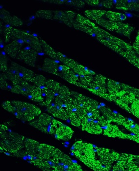 CX3CR1 Antibody