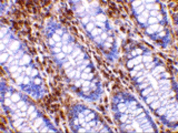 HTRA2 Antibody