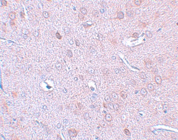 DCLK1 Antibody