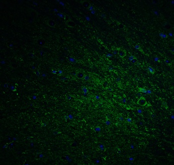 DCLK1 Antibody