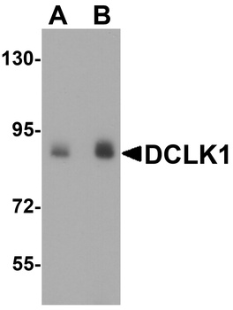 DCLK1 Antibody