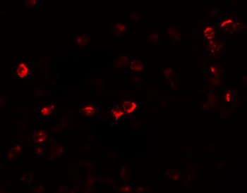 OGFOD1 Antibody