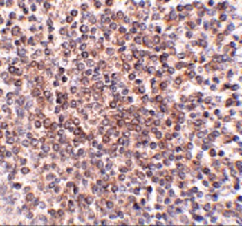 C12orf75 Antibody