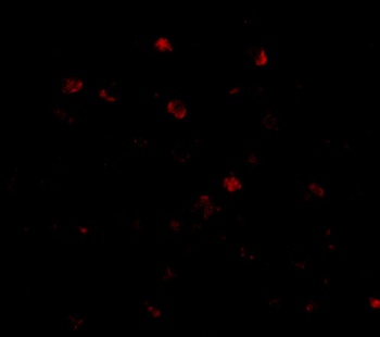NUP160 Antibody