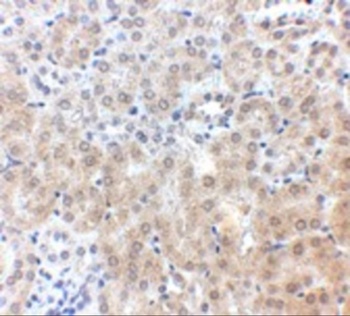 NPC1 Antibody