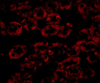 NPC1 Antibody