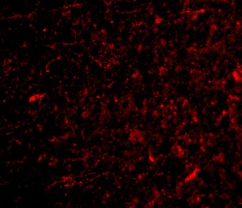 NPAS3 Antibody