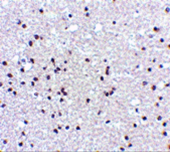 NPAS3 Antibody