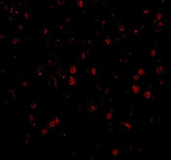 NPAS3 Antibody