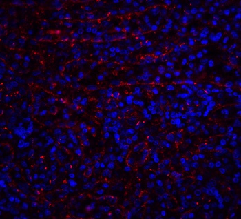 TNFRSF10A Antibody