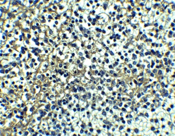 TNFRSF10A Antibody
