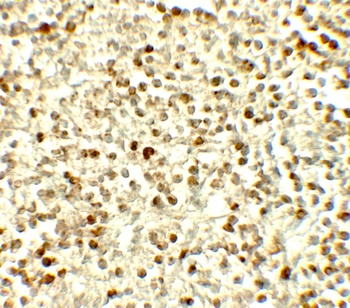 NOX4 Antibody