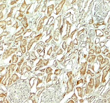 NOX3 Antibody