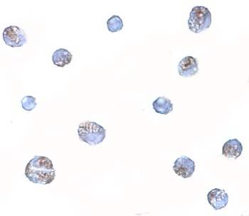Norrin Antibody