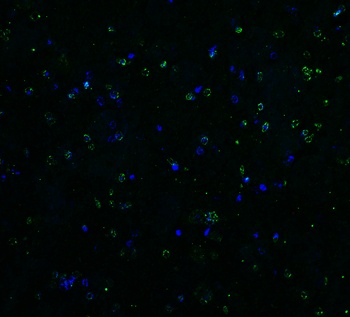 DR5 Antibody