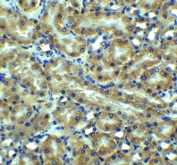 TNFRSF10B Antibody