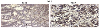 DR5 Antibody