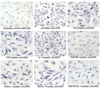 TNFRSF10B Antibody