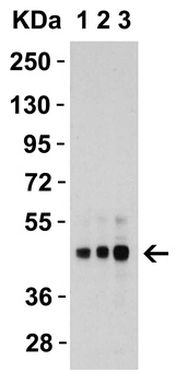 TNFRSF10B Antibody