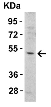 DR5 Antibody