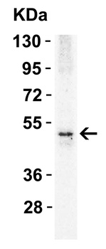 TNFRSF10B Antibody