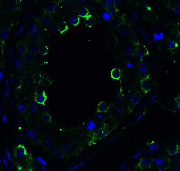 DR5 Antibody